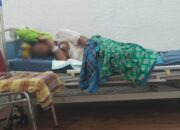 Santri Diduga Dibakar 2 Seniornya di Kolaka Utara Jalani Operasi Debridement Angkat Jaringan Kulit Infeksi