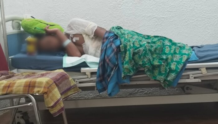 Santri Diduga Dibakar 2 Seniornya di Kolaka Utara Jalani Operasi Debridement Angkat Jaringan Kulit Infeksi